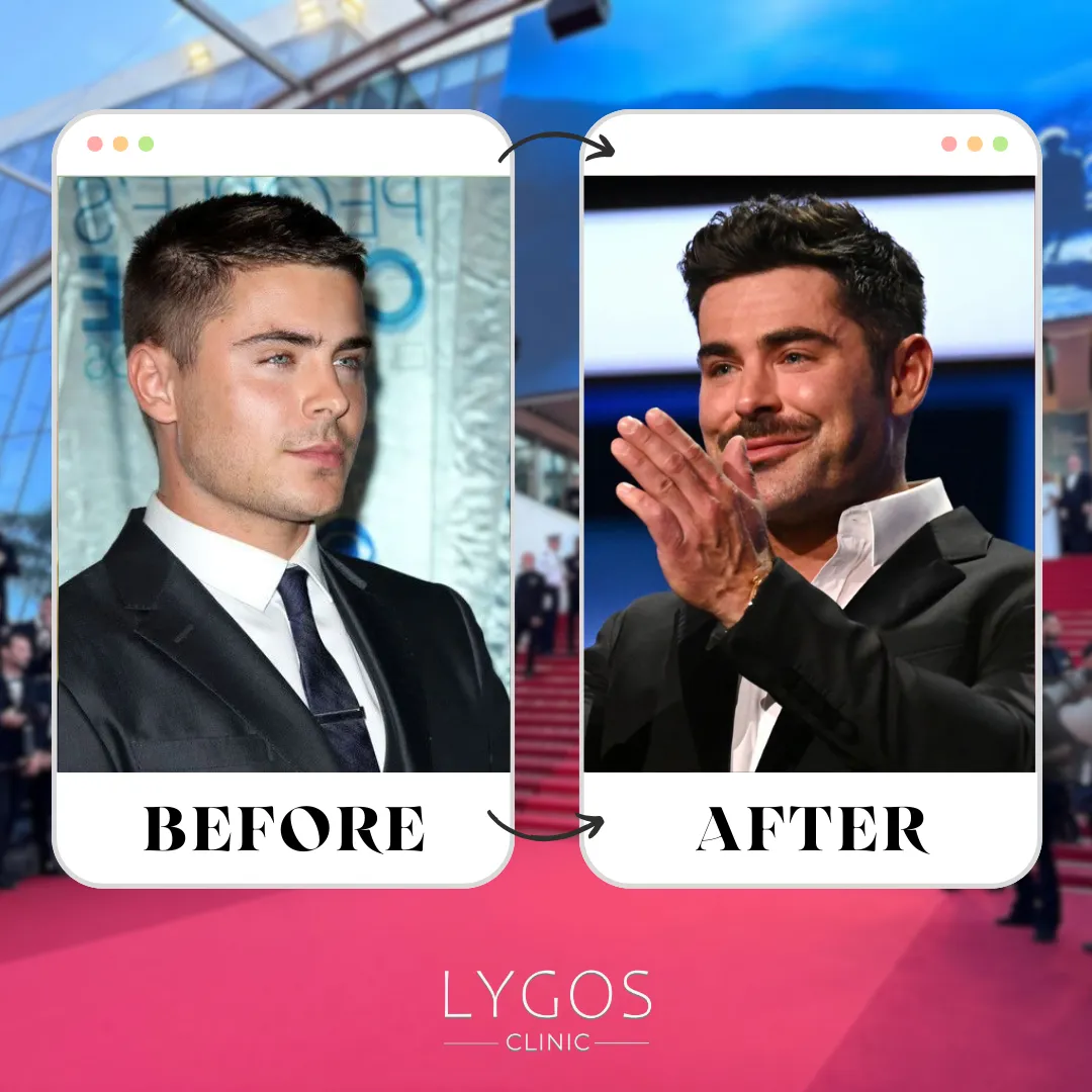 Top 10 Celebrity Transformations in 2025 That Shocked Fans